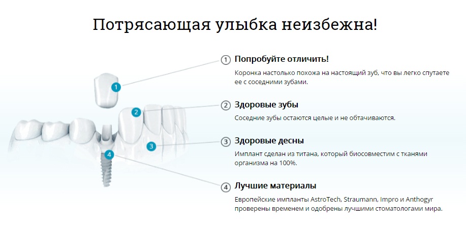 Структура лендинга по модели AIDA.